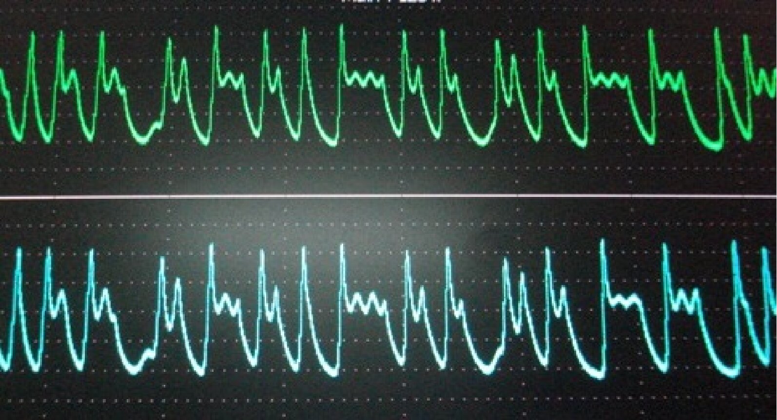 Figure 12