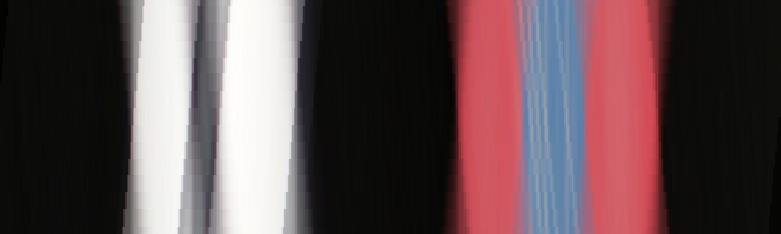Figure 22