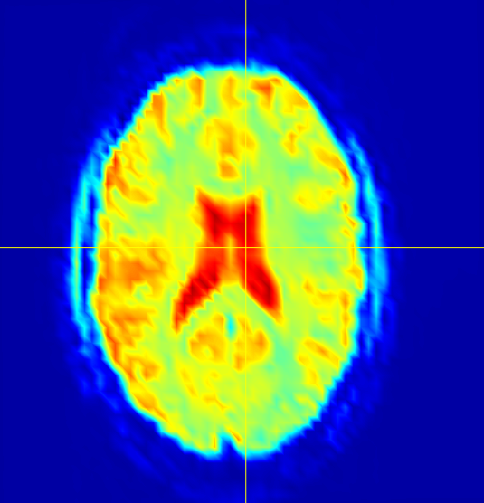 Figure 18