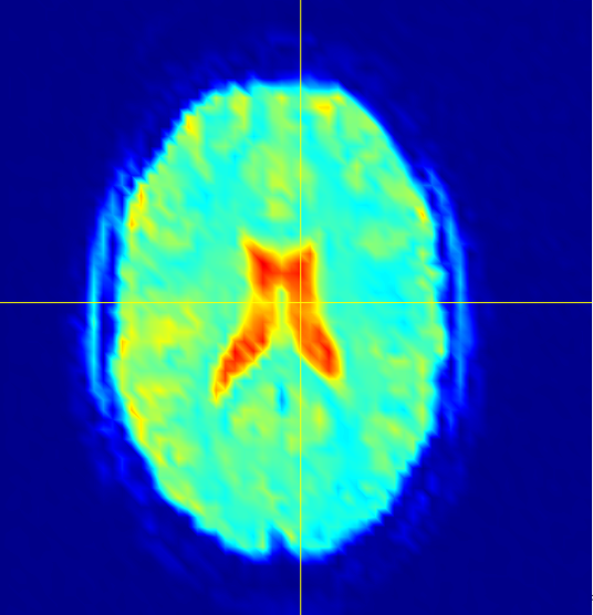 Figure 19