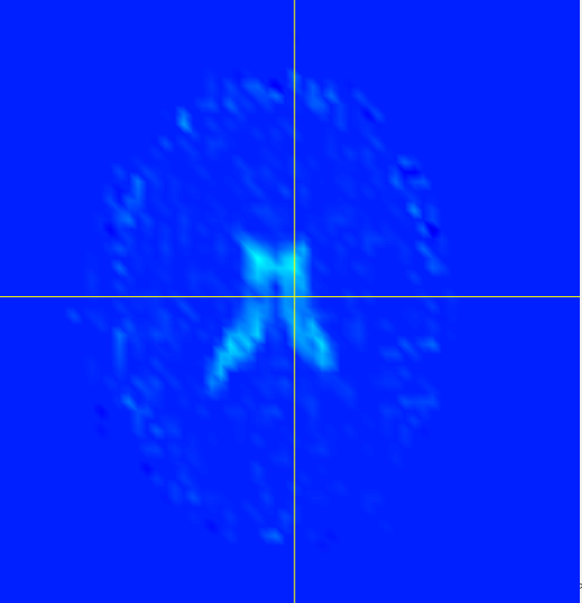 Figure 22