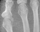 Figure 25