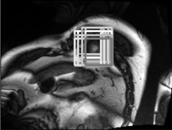 Figure 16