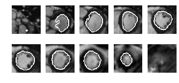 Figure 22
