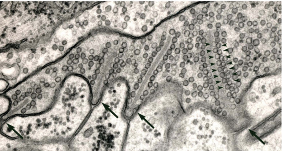 Figure 18