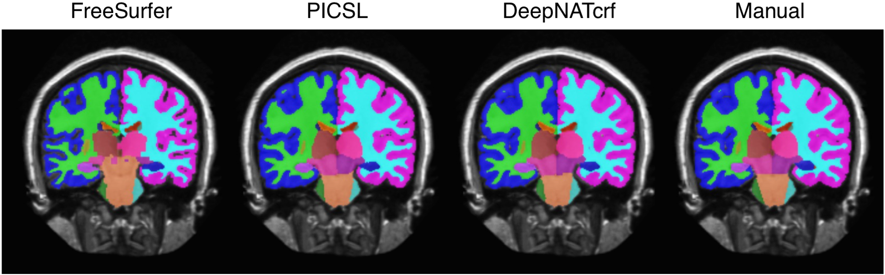 Figure 13