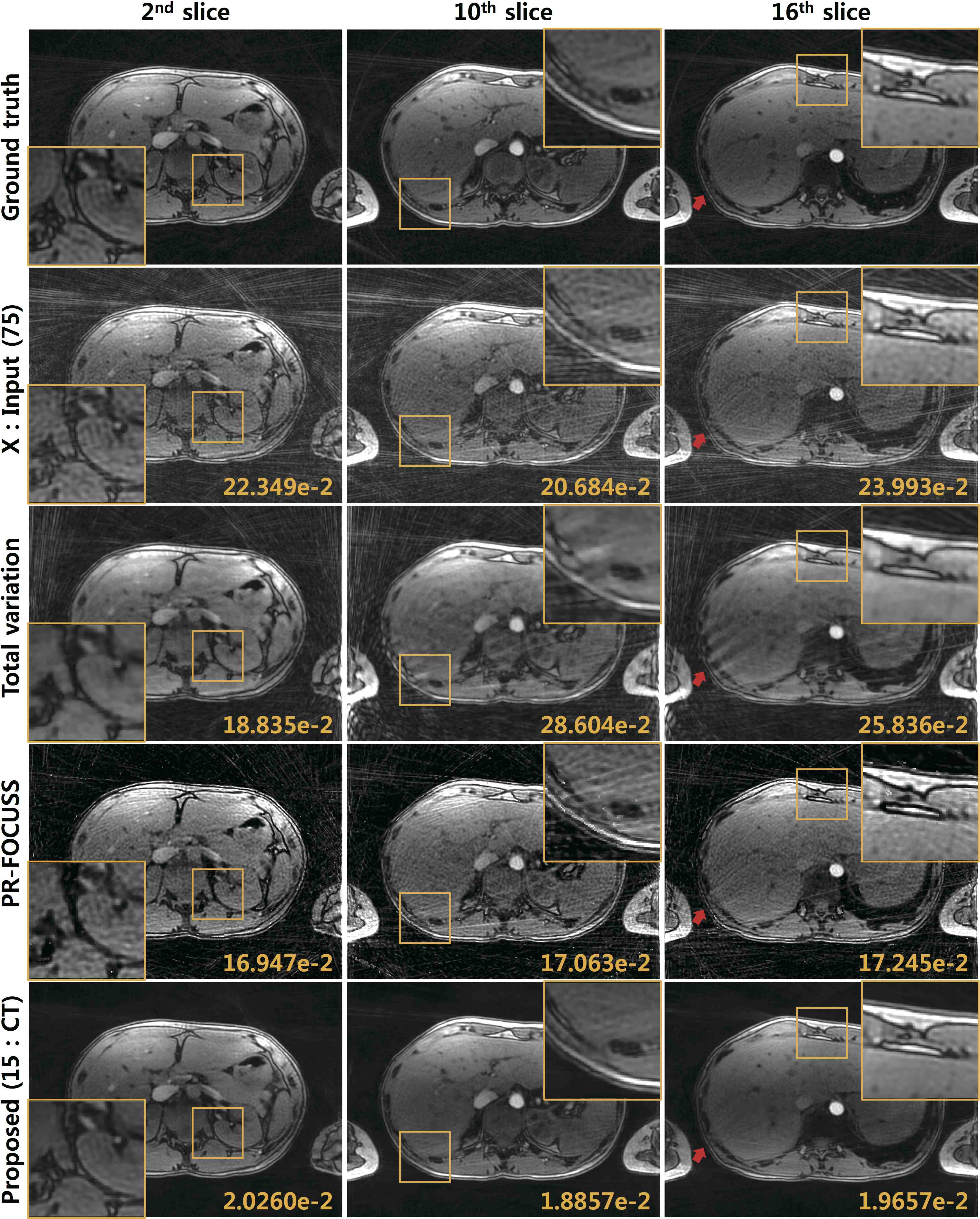 Figure 14