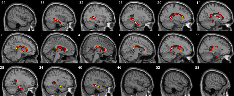 Figure 22