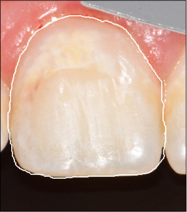 Figure 10