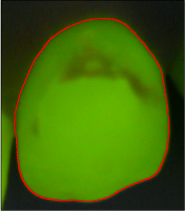 Figure 12