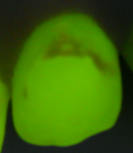 Figure 15