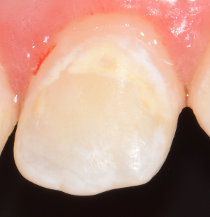 Figure 17