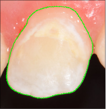 Figure 18