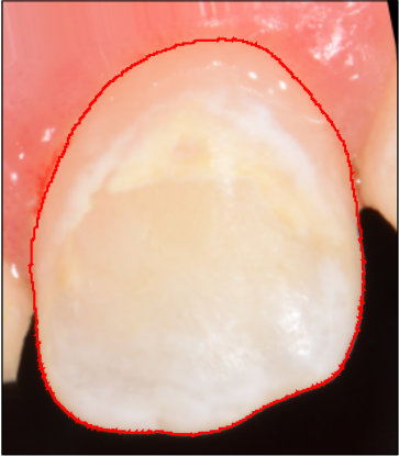 Figure 19