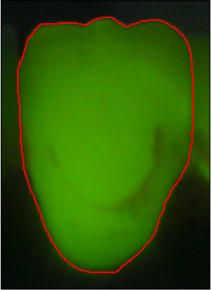 Figure 21