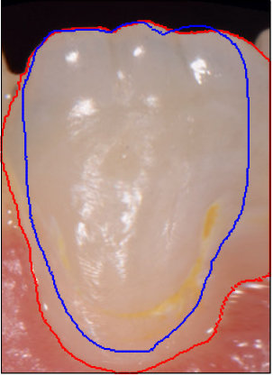 Figure 22