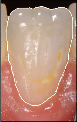 Figure 23
