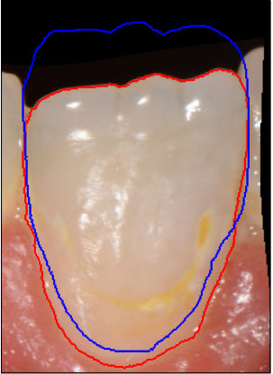 Figure 24