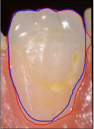 Figure 25
