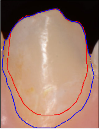 Figure 26
