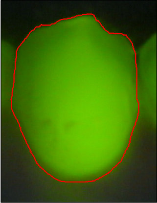 Figure 28