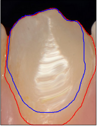 Figure 29