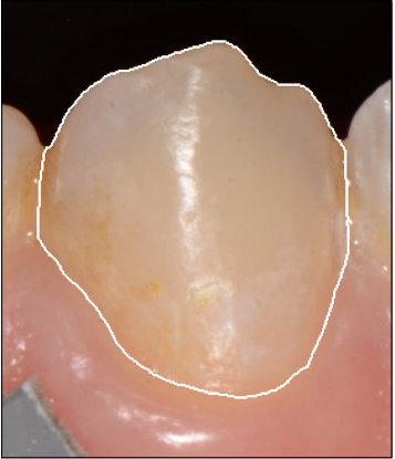 Figure 30