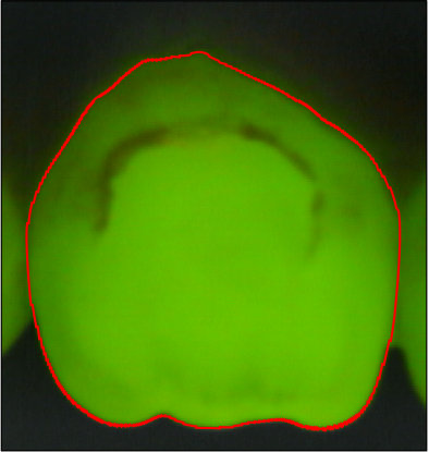 Figure 31