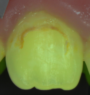 Figure 32