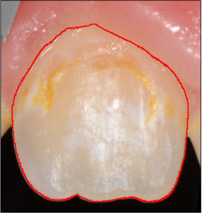 Figure 33