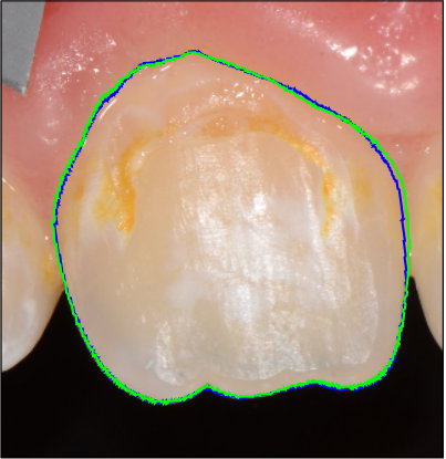Figure 34