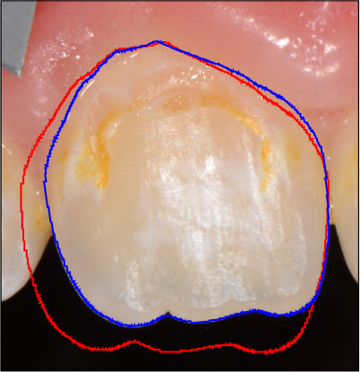 Figure 35