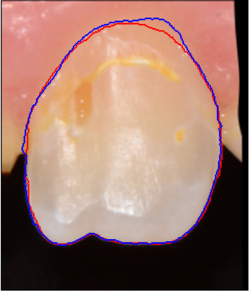Figure 36