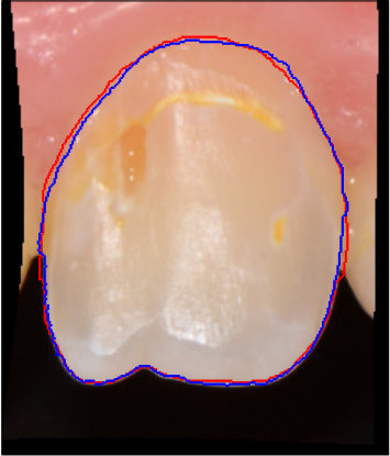 Figure 37