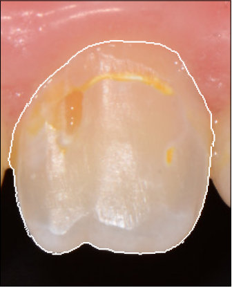 Figure 40