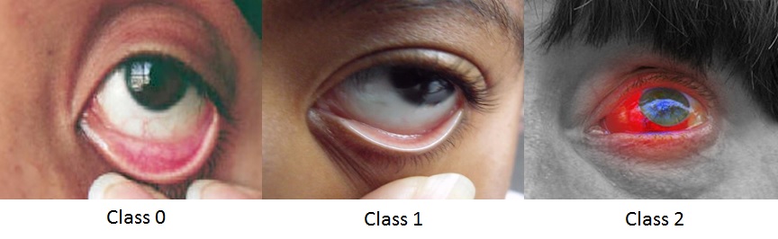Figure 15