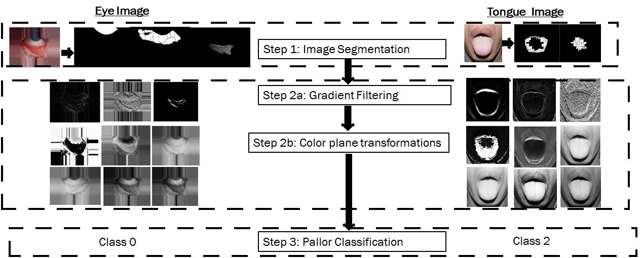 Figure 16
