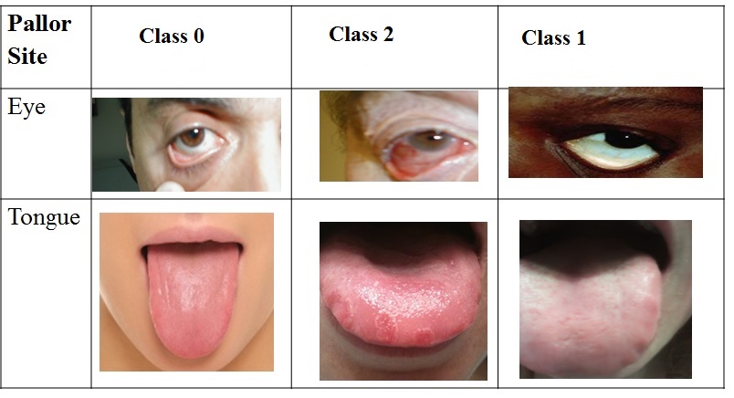 Figure 18