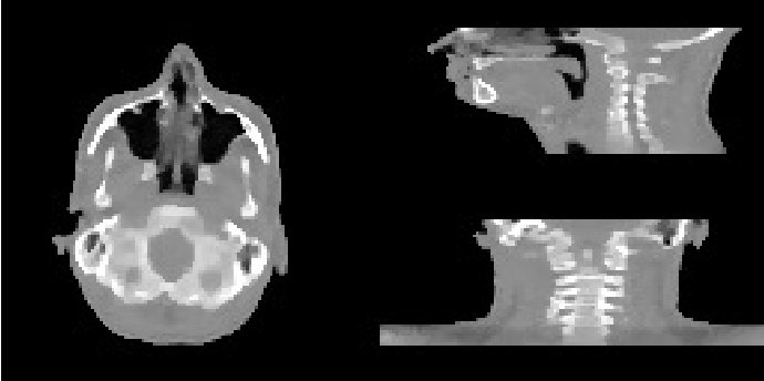 Figure 11