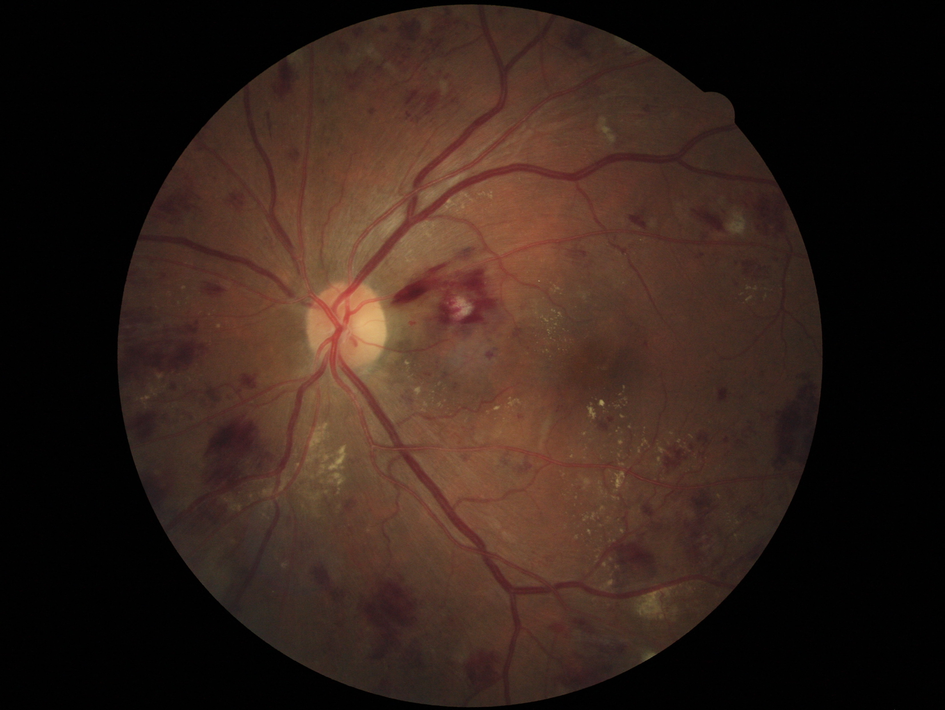 Figure 11