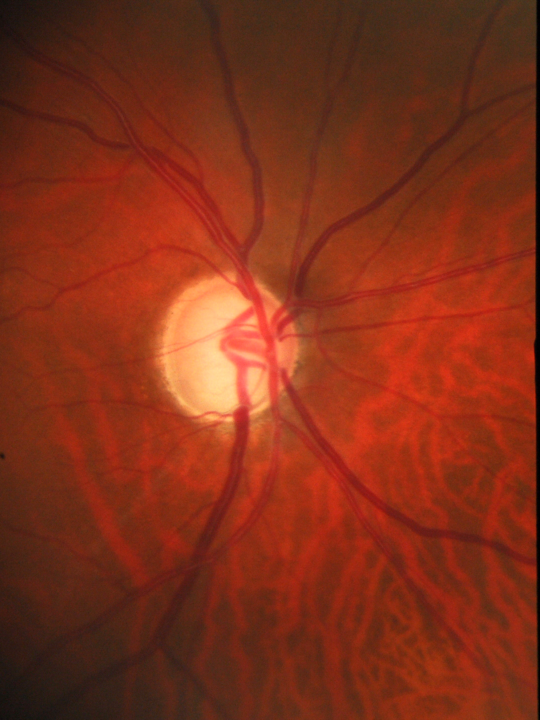 Figure 14