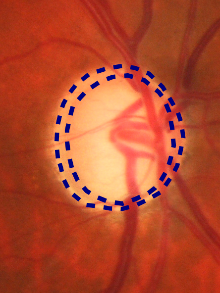 Figure 15