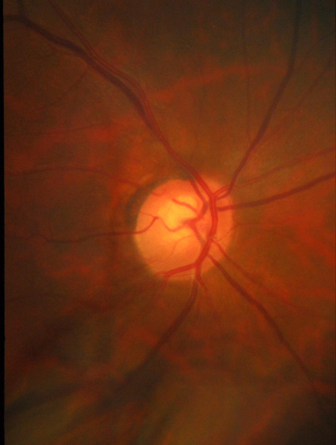 Figure 16