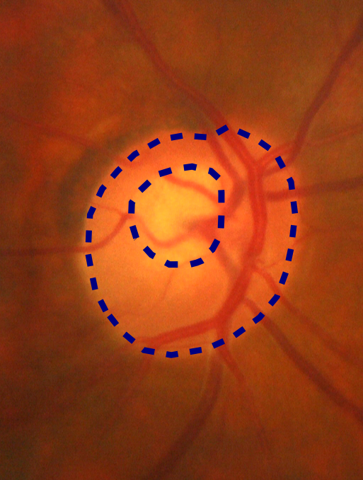 Figure 17