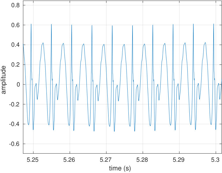 Figure 30