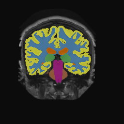Figure 11
