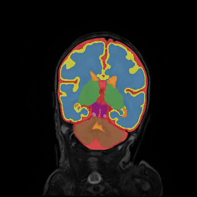Figure 13
