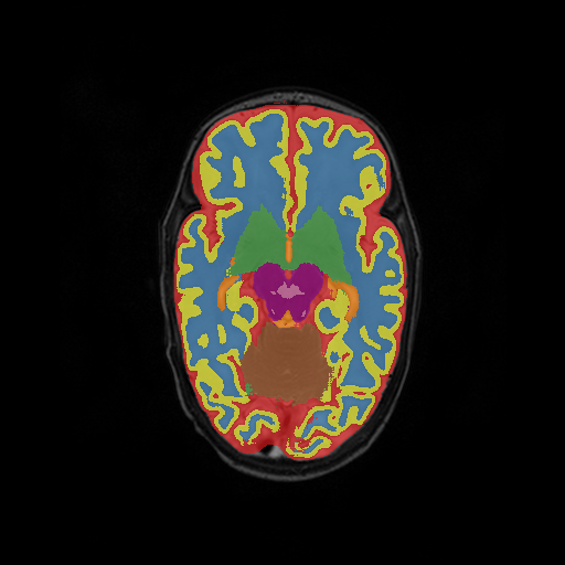 Figure 15