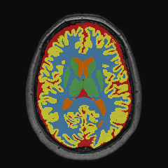 Figure 16