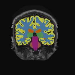 Figure 17
